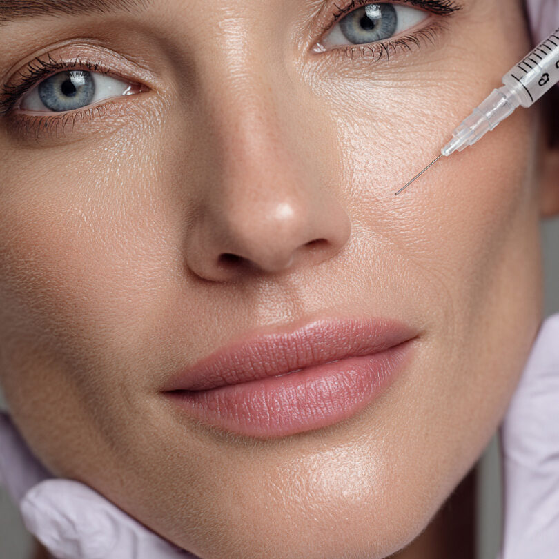 8-point filler facelift
