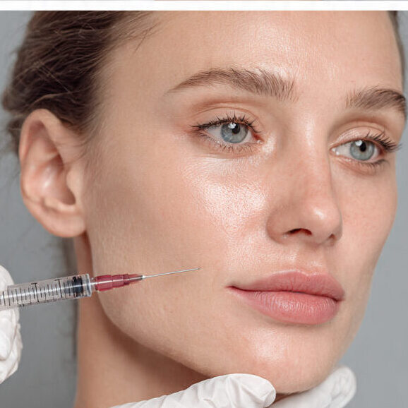8-point filler facelift