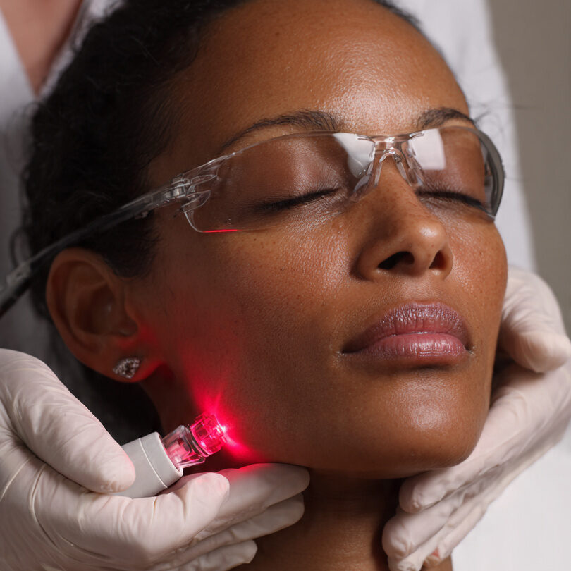 These 8 Lasers Are Safe for Melanin-Rich Skin