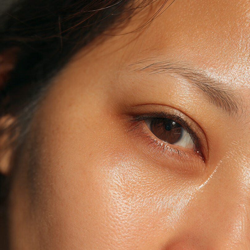10 Ways to Treat Puffy Eyes